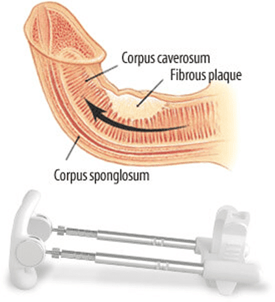 Size Genetics Curvature